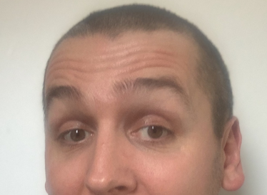 A picture of a man with a shaved head.